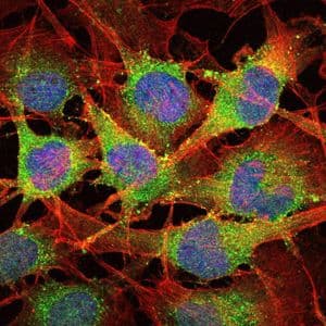SMAD2 Antibody (clone 5G7)
