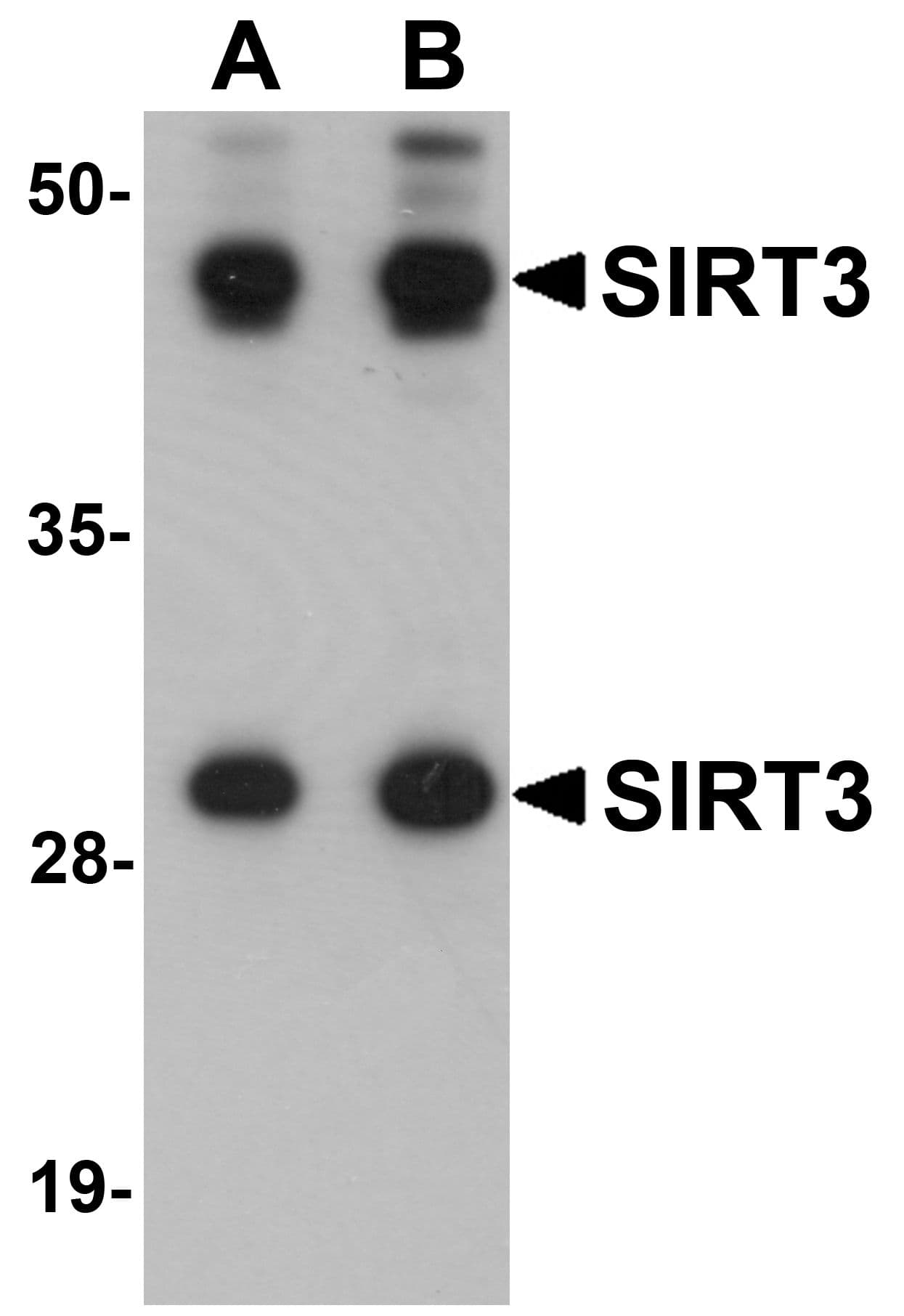 SIRT3 / Sirtuin 3 Antibody