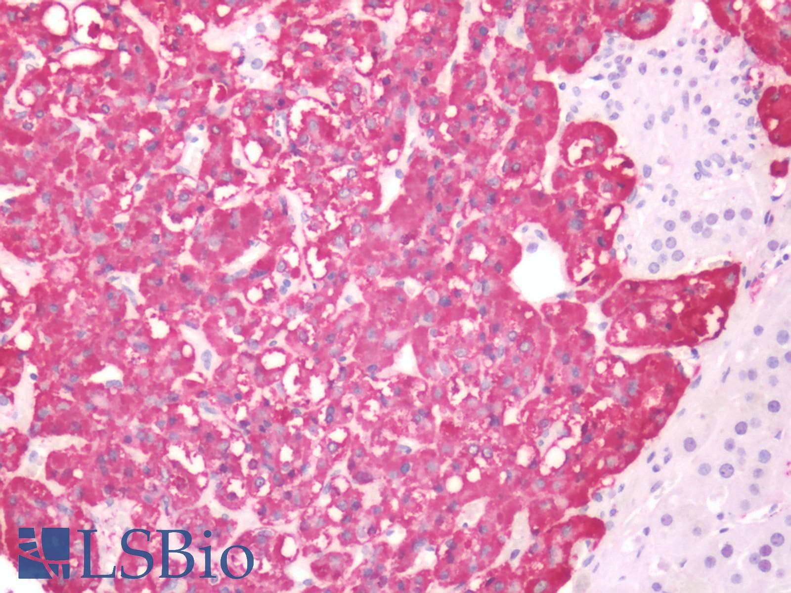 PathPlus™ HTR4 / 5-HT4 Receptor Antibody (Cytoplasmic Domain)