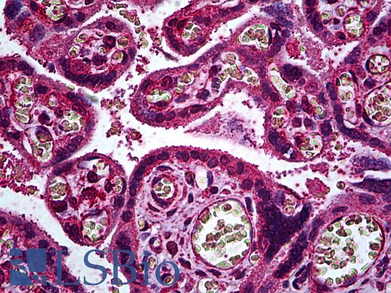 IHC-plus™ ERBB3 / HER3 Antibody (clone 2E9)