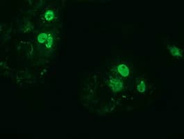 ZIM2 Antibody (clone OTI5E12)