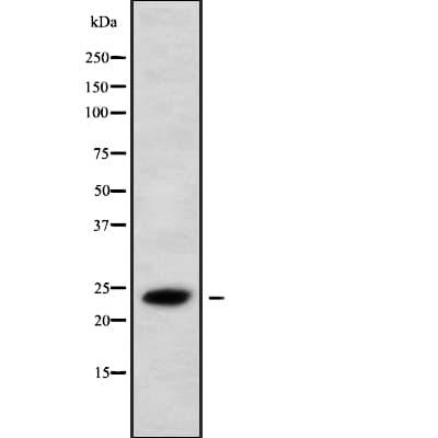 HPGDS Antibody