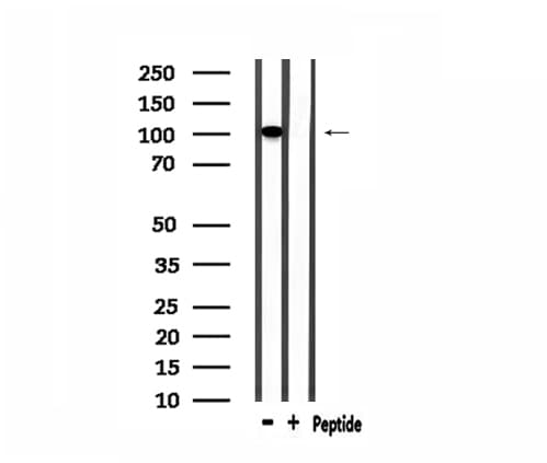 GTF3C2 Antibody