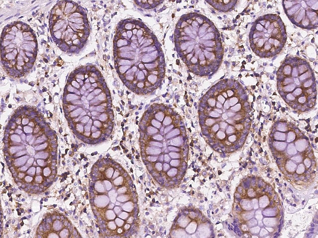 Polyclonal Rabbit anti-Human FAU / Fub1 Antibody (IHC, WB)