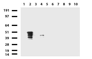 KRT7 / CK7 / Cytokeratin 7 Antibody (aa1-114, clone UMAB161)