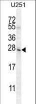 Polyclonal Rabbit anti-Human BHLHA15 Antibody (aa160-189, WB)