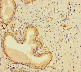 RABEP2 Antibody
