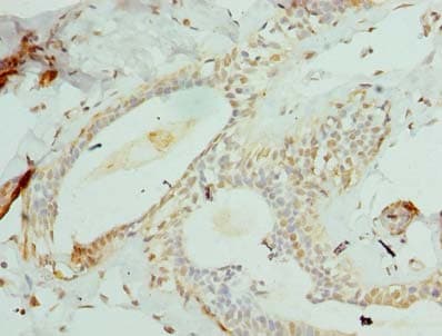 CCDC97 Antibody (Coiled-coil domain)