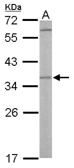 Polyclonal Rabbit anti-Human OTUB1 / OTU1 Antibody (aa1-149, WB)