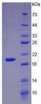 Human IL17A Protein (Recombinant His, N-Terminal)