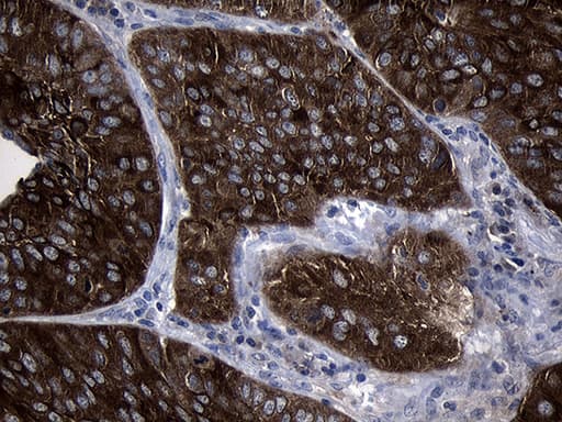 SIRT1 / Sirtuin 1 Antibody (aa552-676, clone OTI5B2)