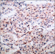 BCL2 / Bcl-2 Antibody