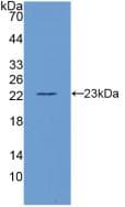 IL-10 Antibody (aa19-178)