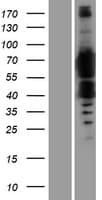 FTO Protein (Over-Expression Lysate Myc-DDK (Flag))