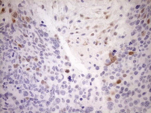 p16INK4a / CDKN2A Antibody (clone OTI7B10)