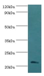 SSX2 Antibody (aa1-188)