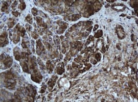 EPHX1 / Epoxide Hydrolase 1 Antibody (aa21-230, clone OTI2D8)