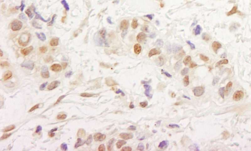 MTA3 Antibody (aa400-450)