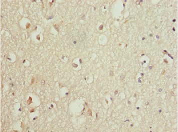 TNRC5 / CNPY3 Antibody