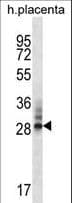 DNAJC27 Antibody (aa1-30)