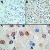 MSX1 Antibody (aa50-100)