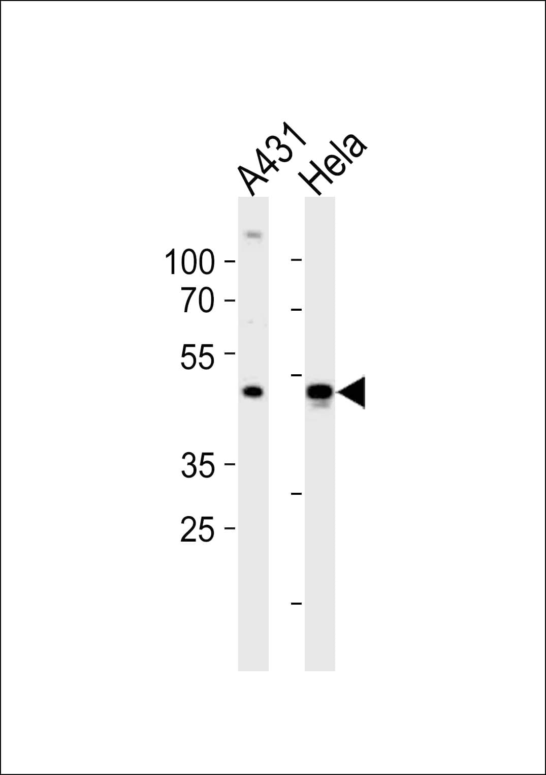 NOVA1 Antibody (aa139-173)