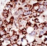 Polyclonal Rabbit anti-Human PIGK Antibody (aa266-297, IHC, WB)