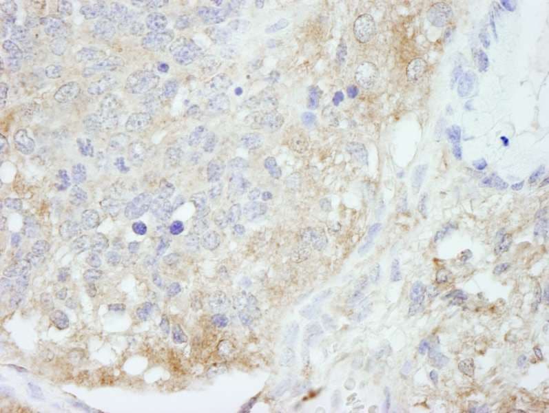 PBXIP1 / HPIP Antibody (aa1-50)