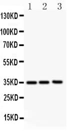 Polyclonal Rabbit anti-Human CSF2 / GM-CSF Antibody (aa63-81, WB)
