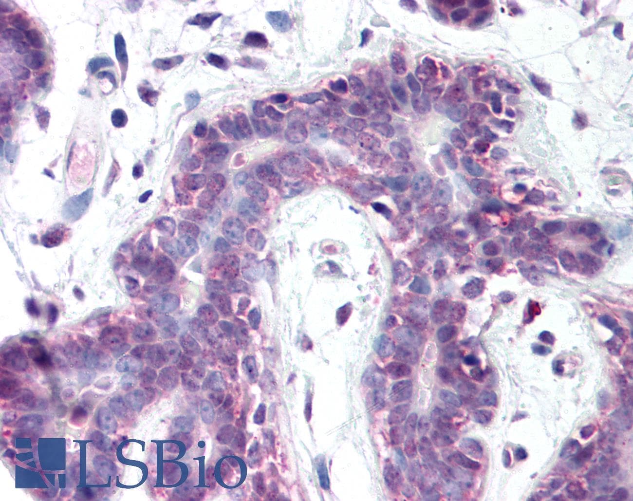 IHC-plus™ PRMT6 Antibody