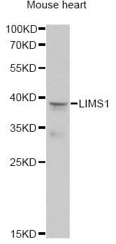 Polyclonal Rabbit anti-Human LIMS1 / PINCH Antibody (IF, WB)