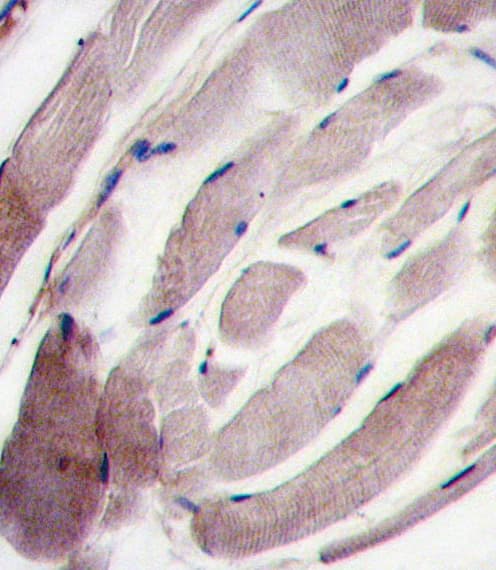 MAPK12 / ERK6 / SAPK3 Antibody (aa336-367)