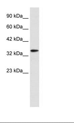 Polyclonal Rabbit anti-Human DLX6 Antibody (aa36-85, IHC, WB)