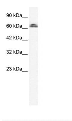 Polyclonal Rabbit anti-Human IVNS1ABP / NS1-BP Antibody (FITC, aa47-96, IHC, WB)