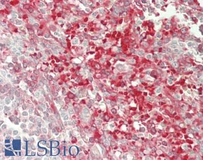 IHC-plus™ CAMKK1 Antibody (aa150-200)