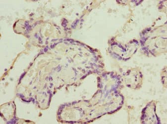 Polyclonal Rabbit anti-Human SH3GL1 / EEN Antibody (IHC)