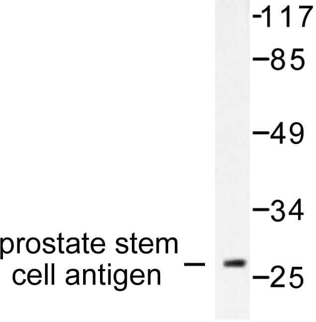 IHC-plus™ PSCA Antibody (aa41-90)