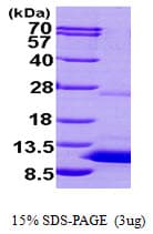 Human S100P Protein (Recombinant His)