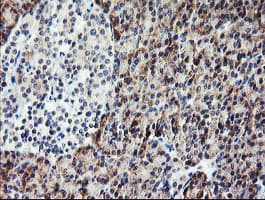 PECAM-1 / CD31 Antibody (clone OTI2E4)