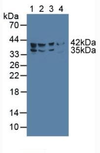 Delta-6 Desaturase / FADS2 Antibody (aa1-130, Biotin)