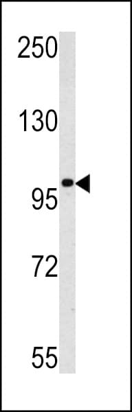 Polyclonal Rabbit anti-Human MAGEC1 Antibody (aa849-880, IHC, WB)