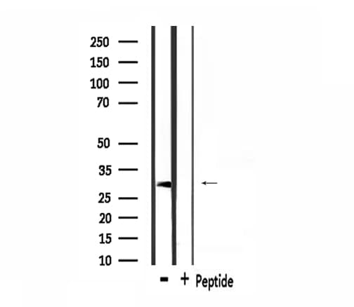 Polyclonal Rabbit anti-Human HCCS Antibody (IHC, IF, WB)