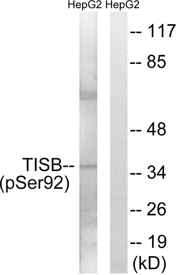 ZFP36L1 Antibody (phospho-Ser92)