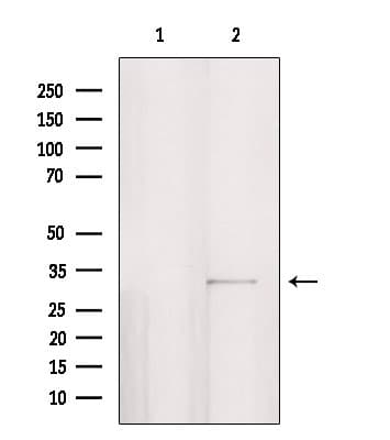 Polyclonal Rabbit anti-Human PPP1R3D Antibody (IF, WB)