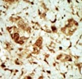 PRKAG3 / AMPK Gamma 3 Antibody (aa148-178)