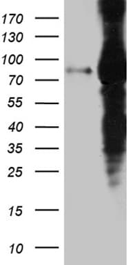 EEF1D Antibody (clone OTI6B3)