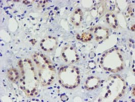 EEYORE / TIGD1 Antibody (aa1-267, clone OTI4G9)