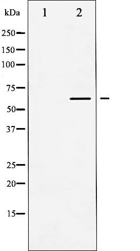 CASP8 / Caspase 8 Antibody
