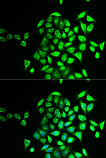 Polyclonal Rabbit anti-Human NAPG Antibody (IHC, IF, WB)