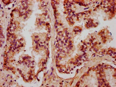 Polyclonal Rabbit anti-Human CXorf36 Antibody (IHC, WB)